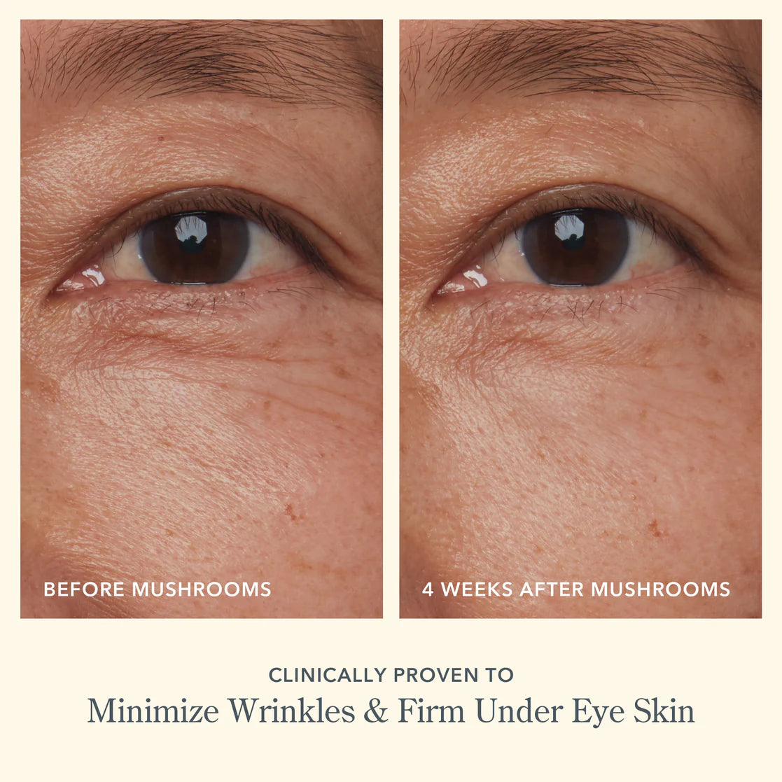 BEEKMAN Mushroom Milk Better Aging Eye Cream