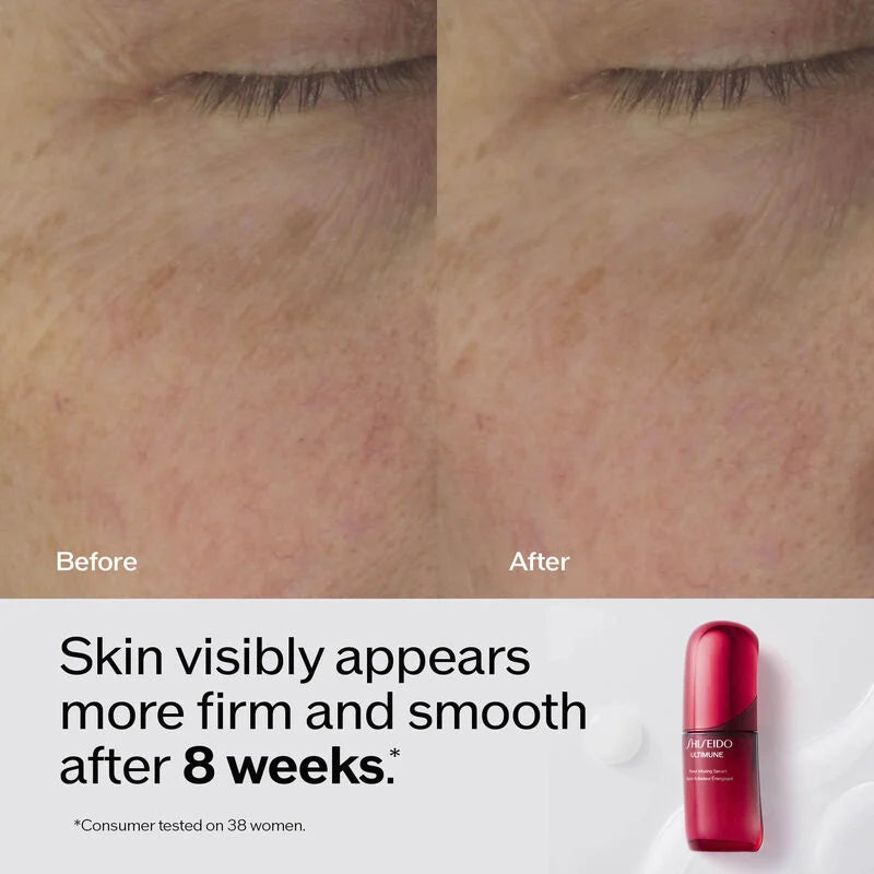 Shiseido Ultimune Power Infusing Serum